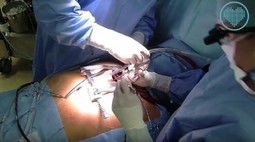 Małoinwazyjna operacja zastawki aortalnej